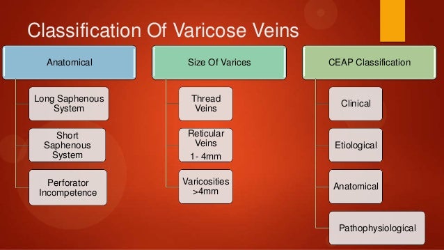 varicose vein classification
